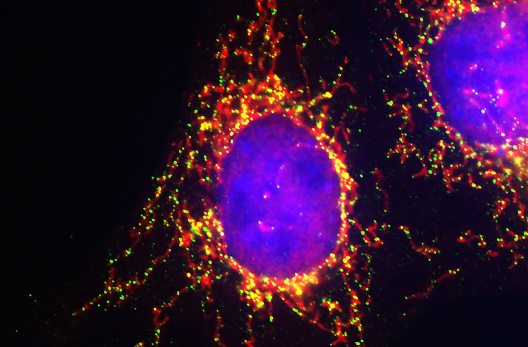 The dynamin-related GTPase Drp1 (green) localizes in foci where it cleaves the mitochondrial network (red).