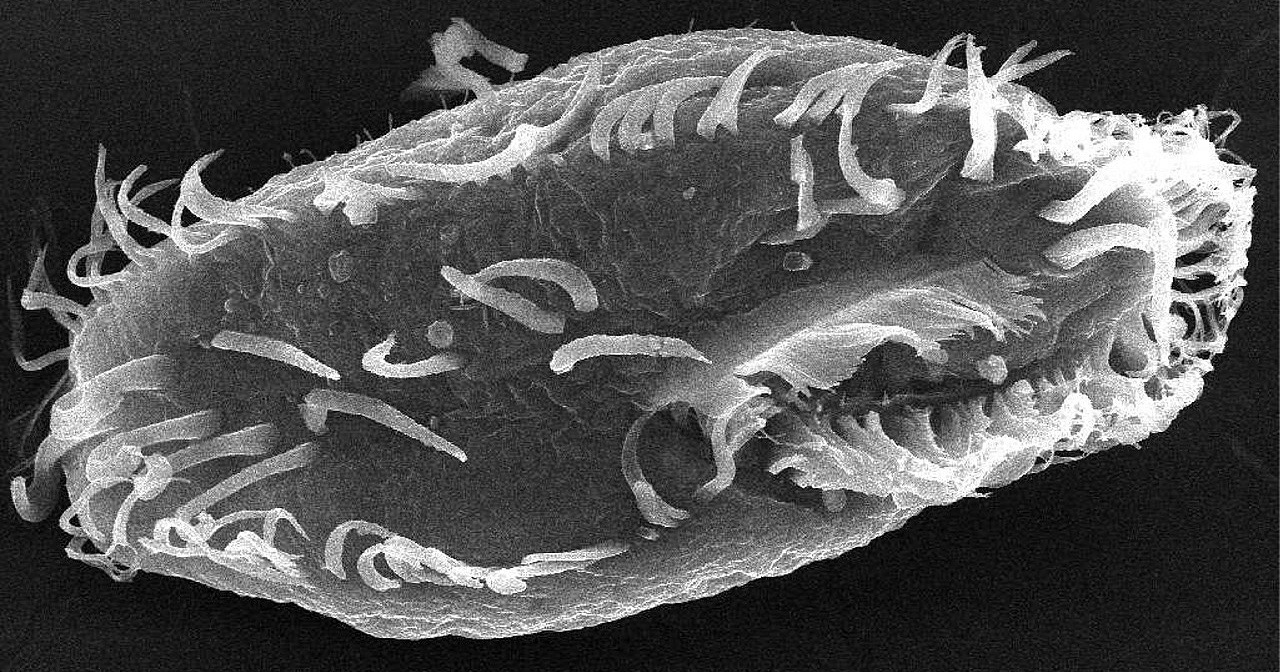 ciliated protozoa