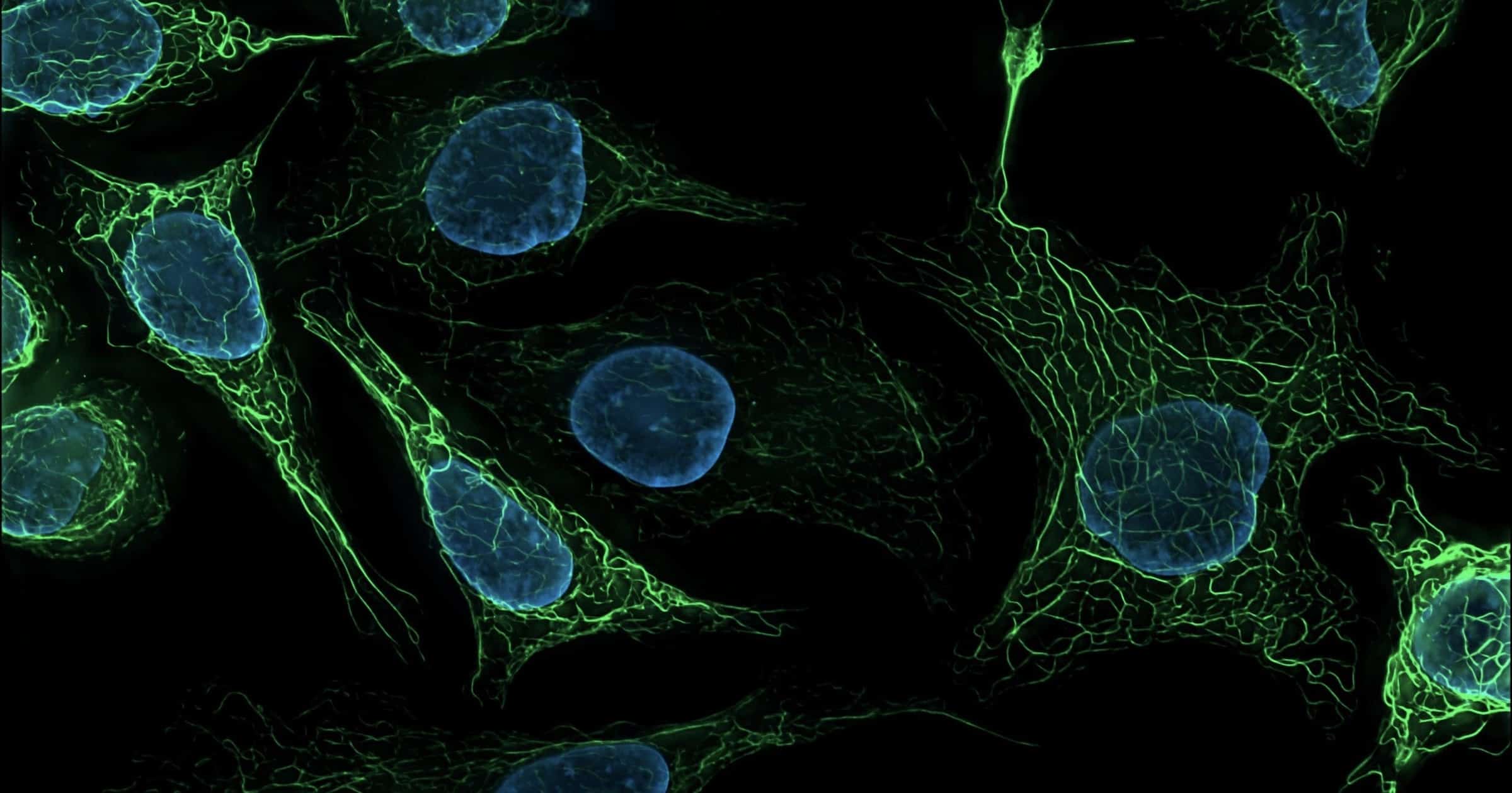 Mapeo de la red pleiotrópica de células humanas