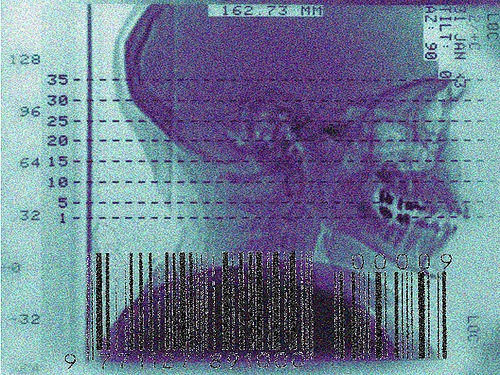 skull x-ray.jpg