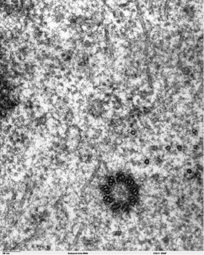 Electron micrograph of a centriole.jpg