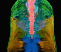 MRI-Monarch-color.jpg