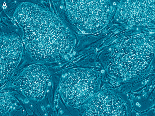human embryonic stem cells.png