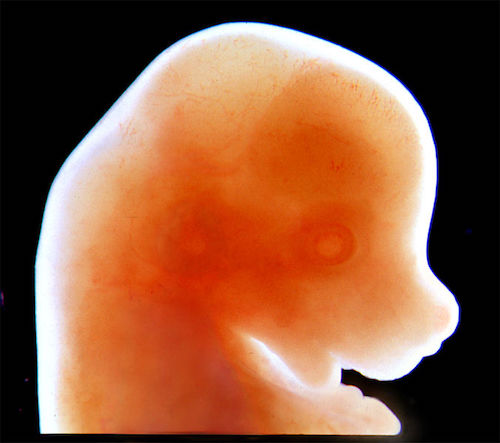 Craniofacial_mouse_embryo.jpg