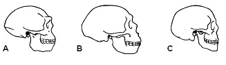 skullcomparison.jpg